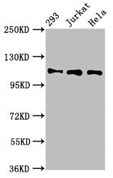 RAB3GAP1 Antibody