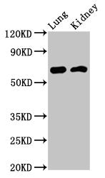 IQCB1 Antibody