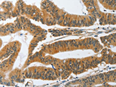 PIK3R3 Antibody