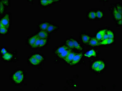 DPYD Antibody