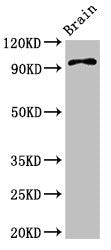 ABR Antibody