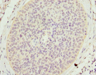 SCGB2A2 Antibody