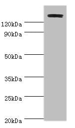 TP53BP2 Antibody