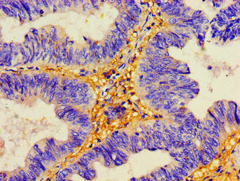 DSG2 Antibody