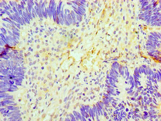 GCKR Antibody