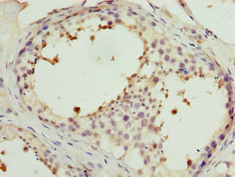 PPP1R7 Antibody