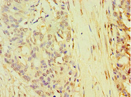 TARBP2 Antibody