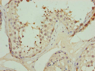 TRIP13 Antibody