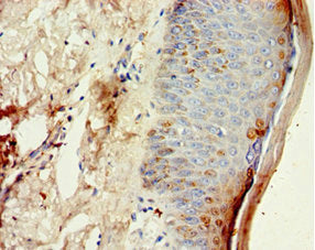 CST6 Antibody