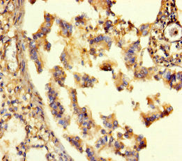 GABRA6 Antibody