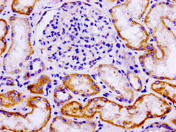 LAMA3 Antibody
