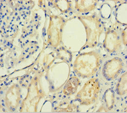 PLA2R1 Antibody