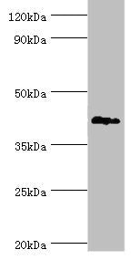 TDG Antibody