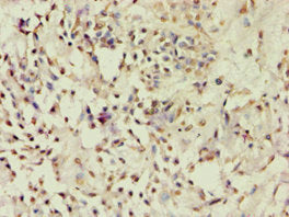 ACVR2B Antibody