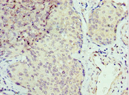 SEPT6 Antibody
