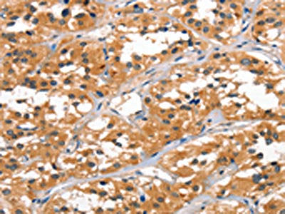 ALOX15 Antibody