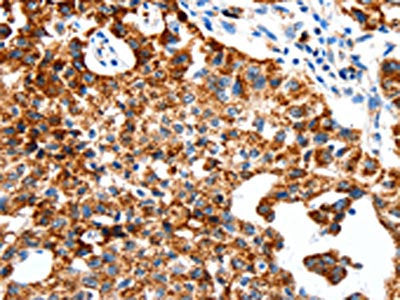 SLC2A1 Antibody