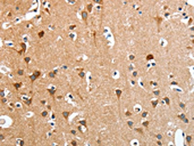 ANKRD54 Antibody