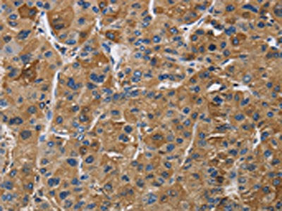 IGF2R Antibody
