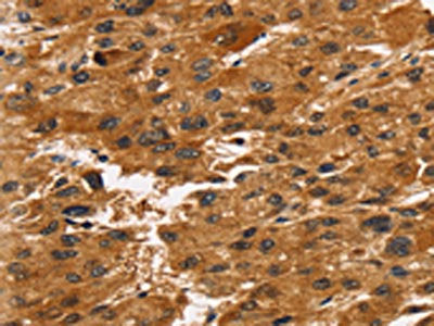 TACC2 Antibody