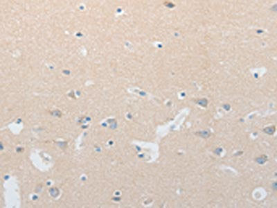 NOTCH2 Antibody