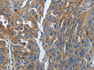 SOCS1 Antibody