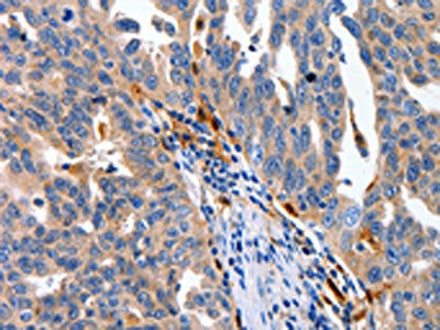 IL18 Antibody