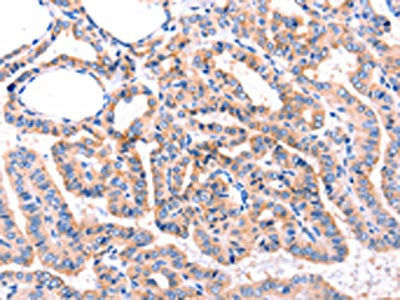ADRBK1 Antibody