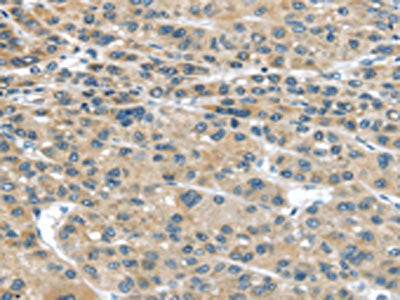 IGFBP4 Antibody