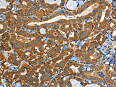 EPHB3 Antibody