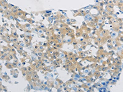 CLEC4C Antibody