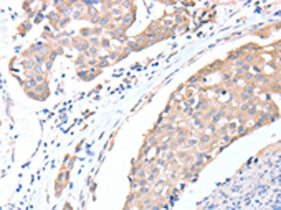 ACTL8 Antibody
