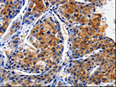 CLCA4 Antibody