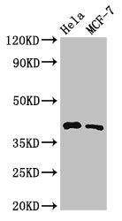 HLA-B Antibody
