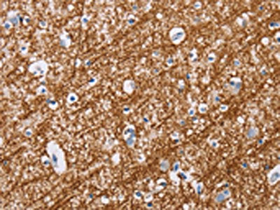 MAG Antibody