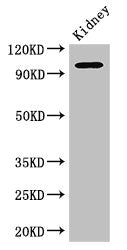 AAK1 Antibody
