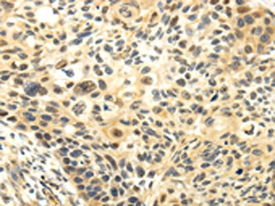 CDKN1A Antibody