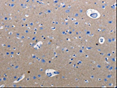 RAB3C Antibody
