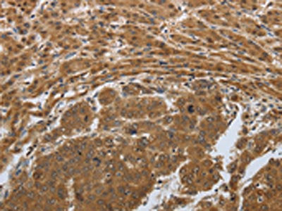 PSMD6 Antibody