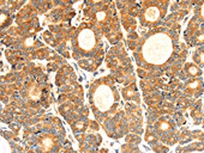 CYP7A1 Antibody