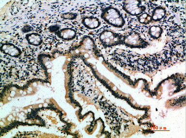 IL17B Antibody