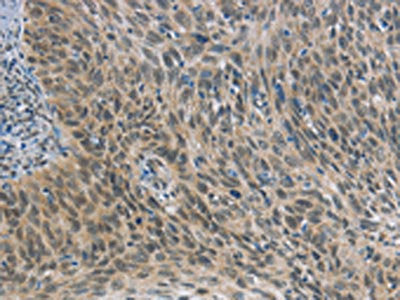 FOXF1 Antibody