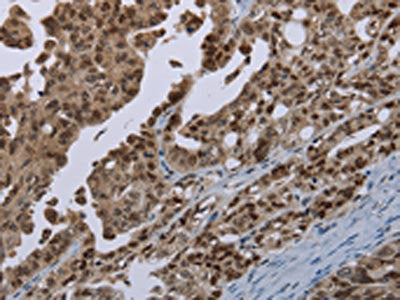 MAGEB18 Antibody
