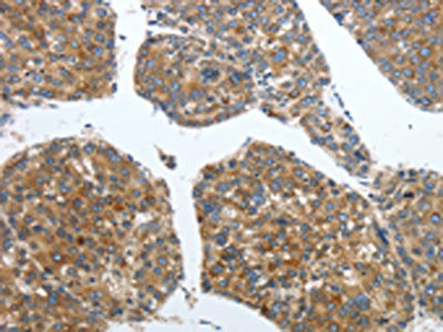 PDK2 Antibody