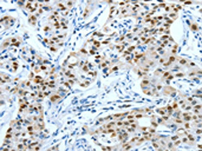 JUN Antibody