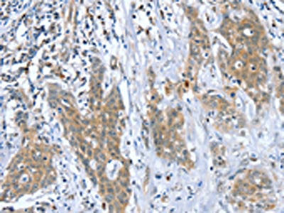 DSTYK Antibody