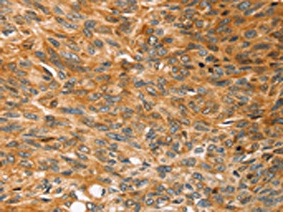 SOX11 Antibody