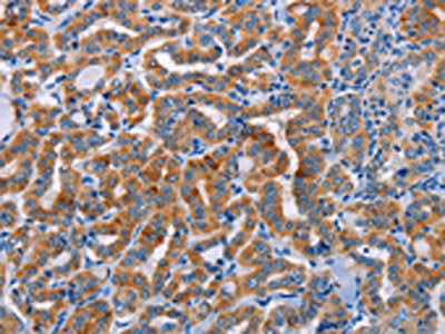 ALG12 Antibody