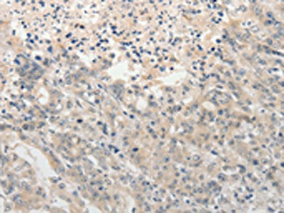 ADAMTS6 Antibody