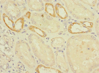 C2orf76 Antibody